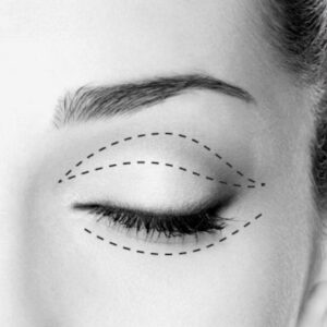 Departamento de Oculoplastía y Vías Lagrimales